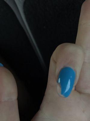 The chipped nail.