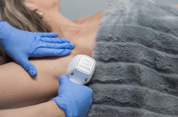 Diolaze XL Laser Hair Removal