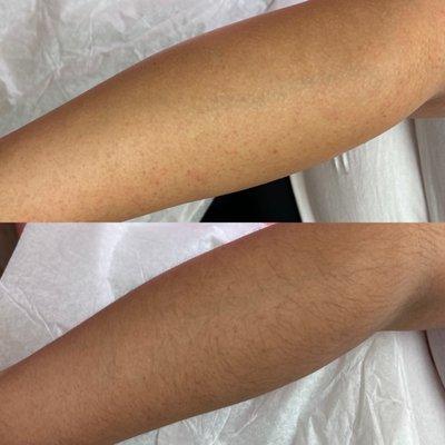 This is the before and after of my arm wax!