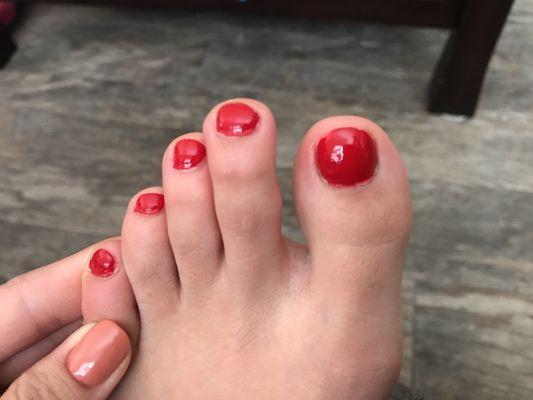 Really bad pedicure polish job too.