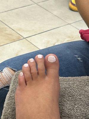 Worst pedicure