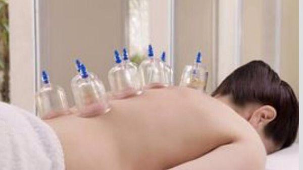 Cupping