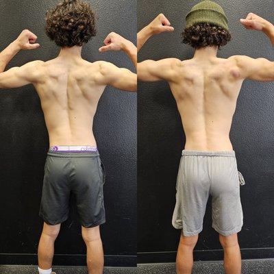 Young kids with scoliosis can straighten out their back with proper mechanics in weight training