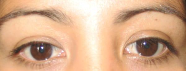 Before eyelash perm