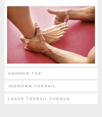 Bunion Surgery & Hammer Toe - Free Consult