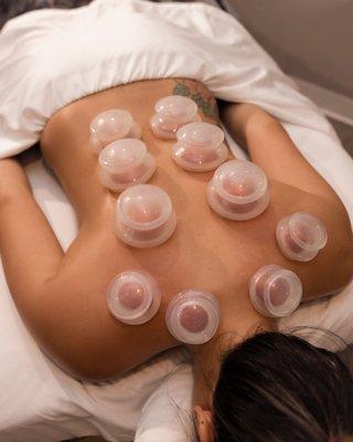 Cupping therapy