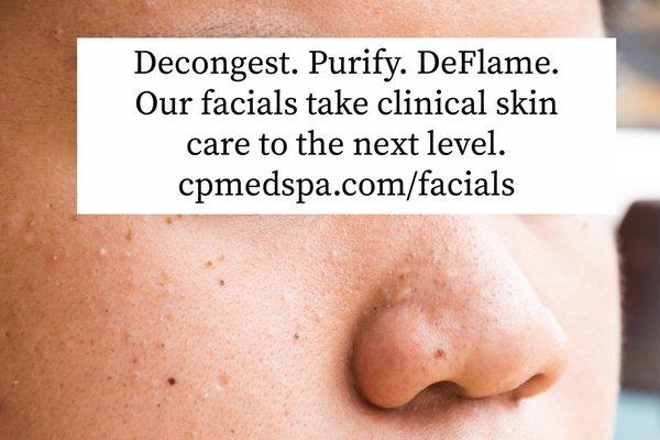 You've never had a facial like the one you'll get CPMedSpa Laser & Skin. Text 910-347-5444 or visit CPMedSpa.com to book online.