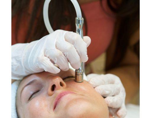 Diamond Tip Microdermabrasion Facial