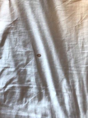 Below is pictures of the stains on the sheets