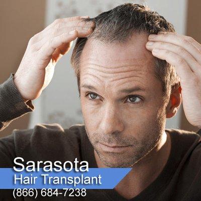 Sarasota Hair Transplant