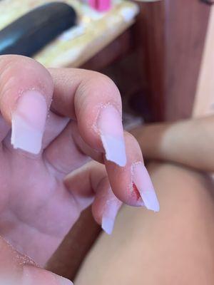 Nail tech filed my skin until i was bleeding