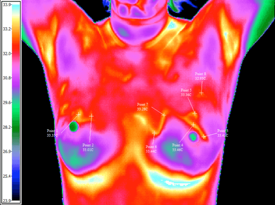 Sample Thermal Image