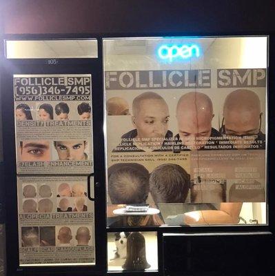 Welcome to Follicle SMP. We will keep the light on for you!