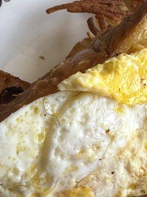 Hair cooked into the eggs.