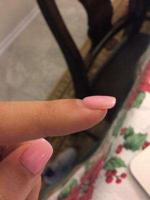 SNS that was applied on index finger was thick (compare to thumb!!)