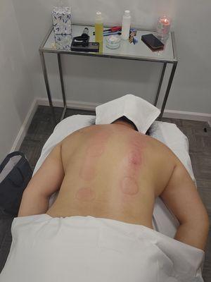 Deep tissue and combination with cupping therapy