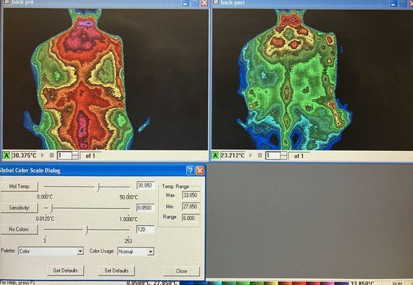 Live Back Infra Red Scan. Before and After.