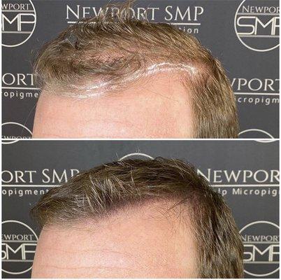 SMP Density Treatment on blonde hair