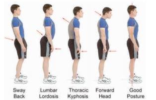 Good posture plays a major role in your overall health.