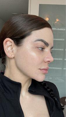 After- depreciated skin texture, lack of healthy glow, lack of subcutaneous fat, looks unnatural and not healthy.