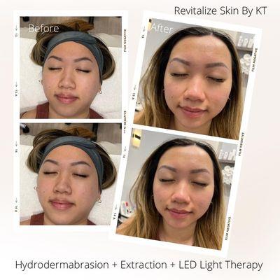 Revitalize Skin By KT