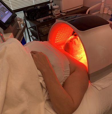 Red light therapy with Hydrojelly mask