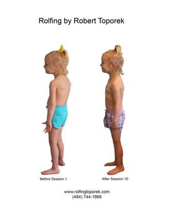 Four year old-begore nd after Rolfing by Robert Toporek 
www.rolfingtoporek.com