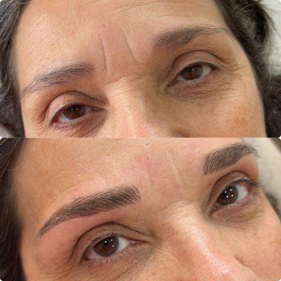 Microbladed eyebrows after breast cancer.