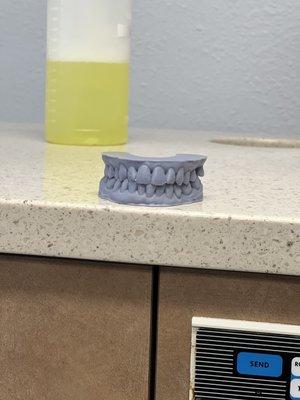 My teeth 3d printed, how cool is that