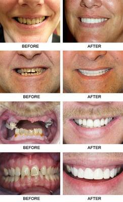 Most of us weren't born with a perfect smile  but the team at Studio 32 can give you one! Take a look at our client's new smiles