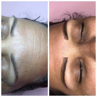 Microblading