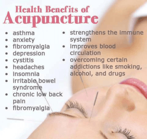 Acupuncture is a great adjunct to have along with chiropractic treatments.