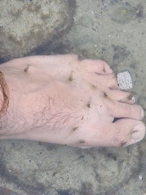 Free shrimp pedicure!  LOL