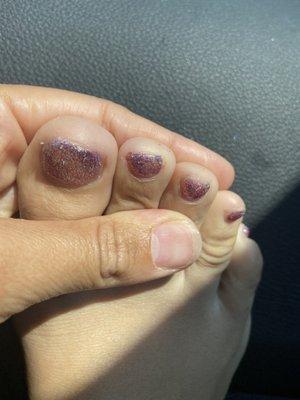 A bad pedi!