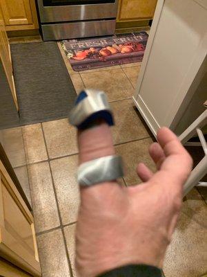 How's the splint looking?