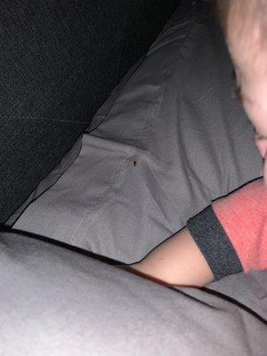 Bed bug that was on my son's face