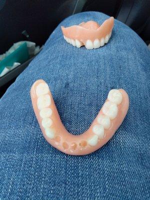 My affordable cheap Dentures.