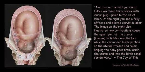 Cervical dilation