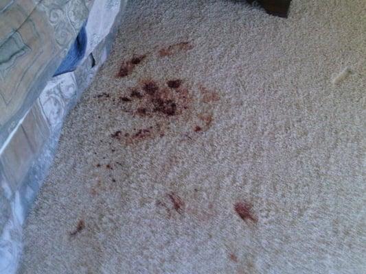 We even remove unwanted blood from your carpet.