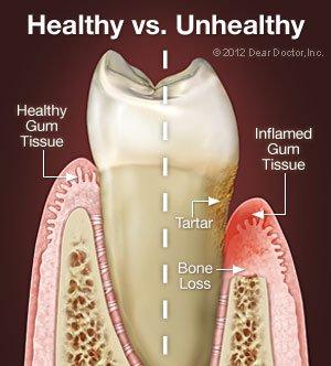 Healthy vs Unhealthy