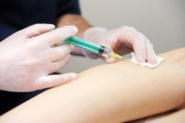 Sclerotherapy treatment