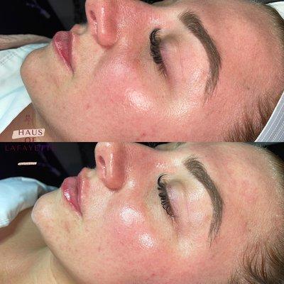 Glass Skin Facial