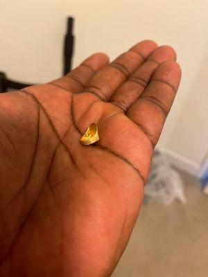 My back gold tooth just came out and I didn't even have these teeth 6 months. What I'm suppose to eat water to preserve them.