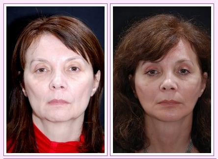 Zollman Plastic Surgery