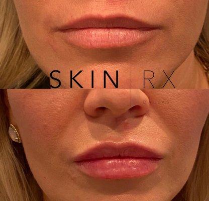 SkinRx Dallas