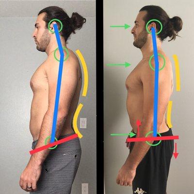 Posture Movement