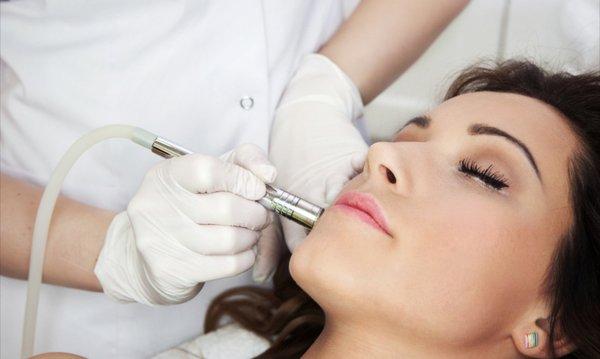 Microdermabrasion!