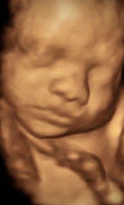 4D ultrasounds with real-time baby movements