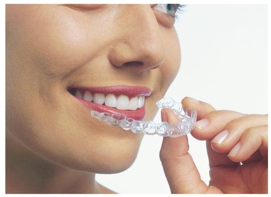 Choose INVISALIGN...The nearly invisible way to straighten your teeth!!