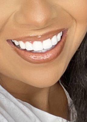 A beautiful, healthy Smile!